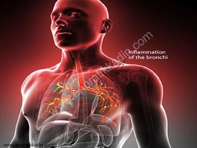 Çocuklarda Bronşit Belirtisi ve Tedavisi