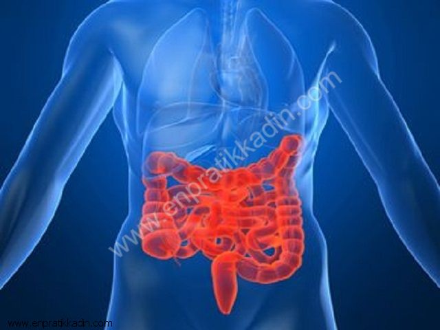 Crohn Hastalığı