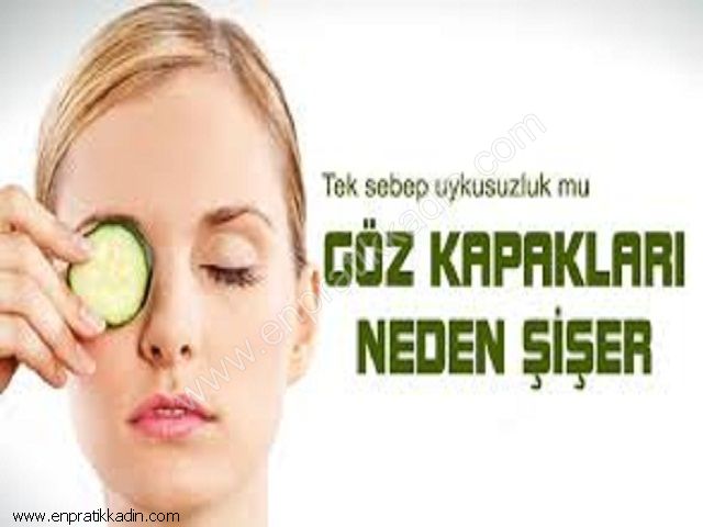 Göz Kapağında Şişme